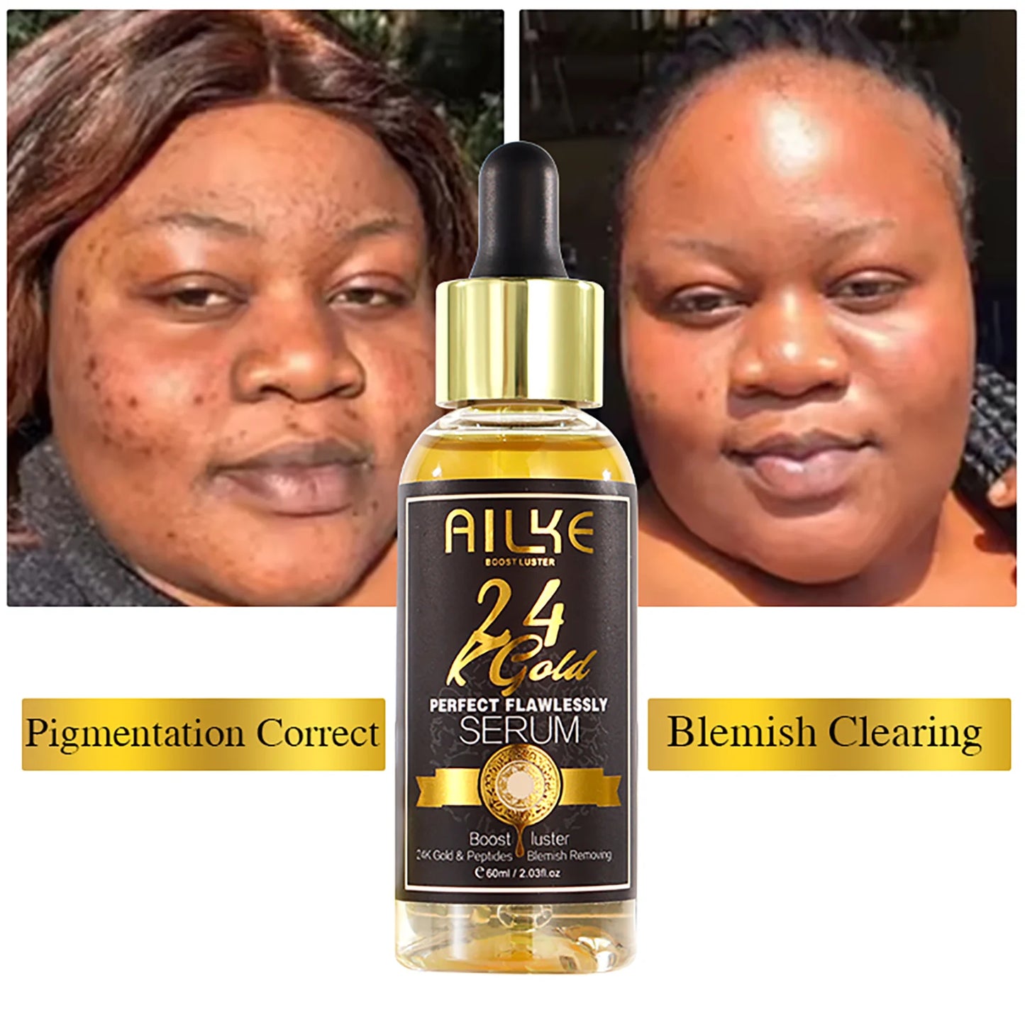 AILKE 24K Gold Skin Care Set Whitening Dark Spots Reduction