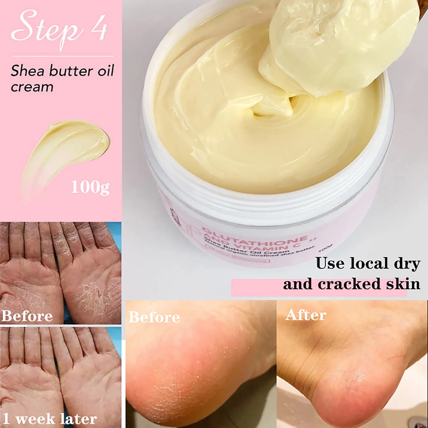 AILKE Whitening Skin Care Cream With Glutathione And Shea Butter